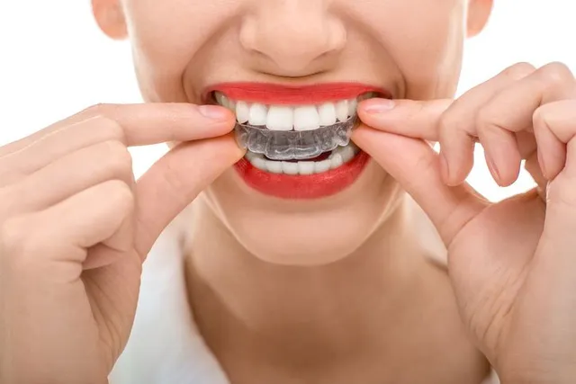 Cosmetic and Clear Aligners